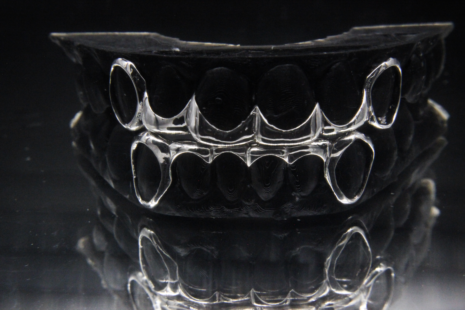 Every Gumbo Grillz set starts here: a precision mold of the client's teeth